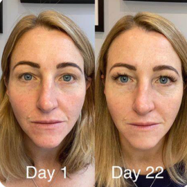 New Zealand pure. Collagen drink