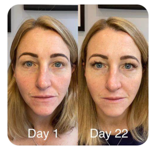 Why Marine Collagen is fantastic for your Skin